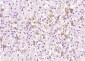 PARP4 Polyclonal Antibody